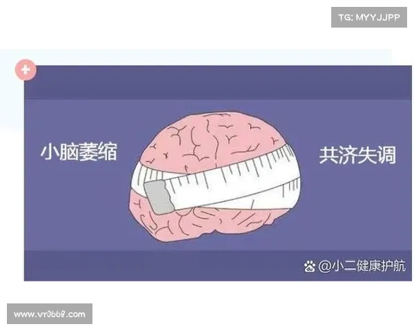 关注大脑健康:大脑萎缩时,身体常出现的三大反应(大脑萎缩最后的结果会怎么样) 关注大脑健康:大脑萎缩时,身体常出现的三大反应(大脑萎缩最后的结果会怎么样)